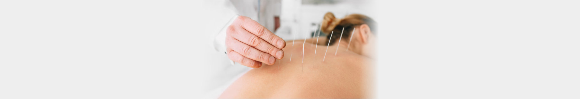 woman on acupuncture therapy